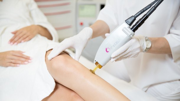 Що треба знати про лазерну епіляцію, перш ніж на неї зважитися